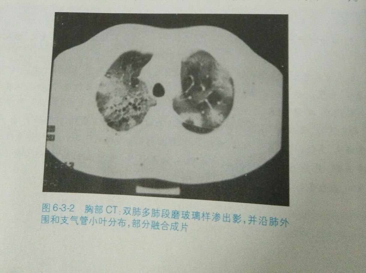 今天让我们一起学习病历。