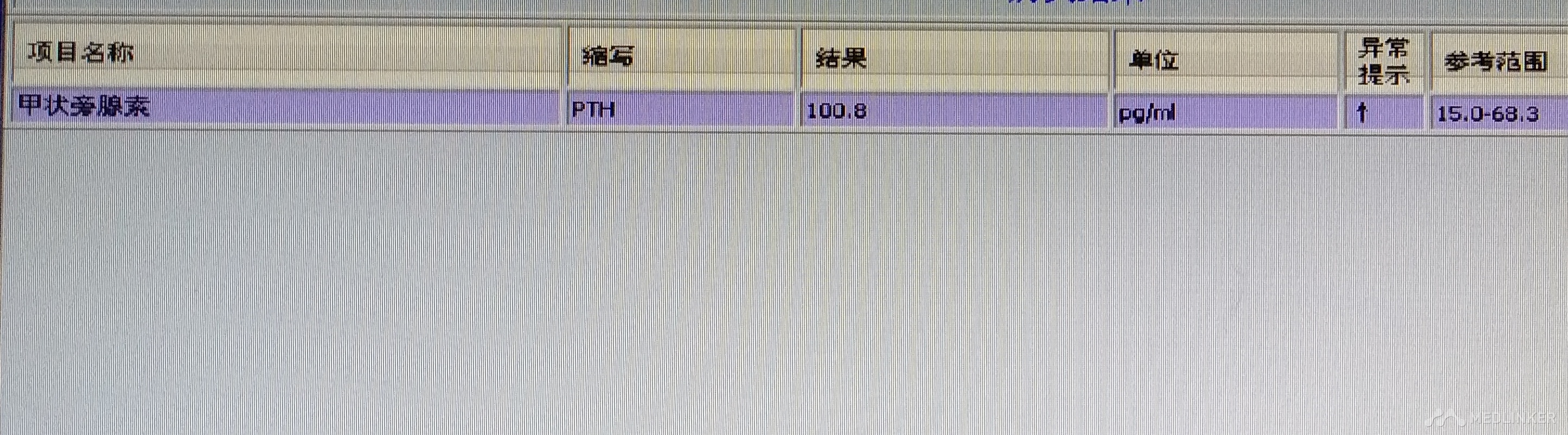 乏力