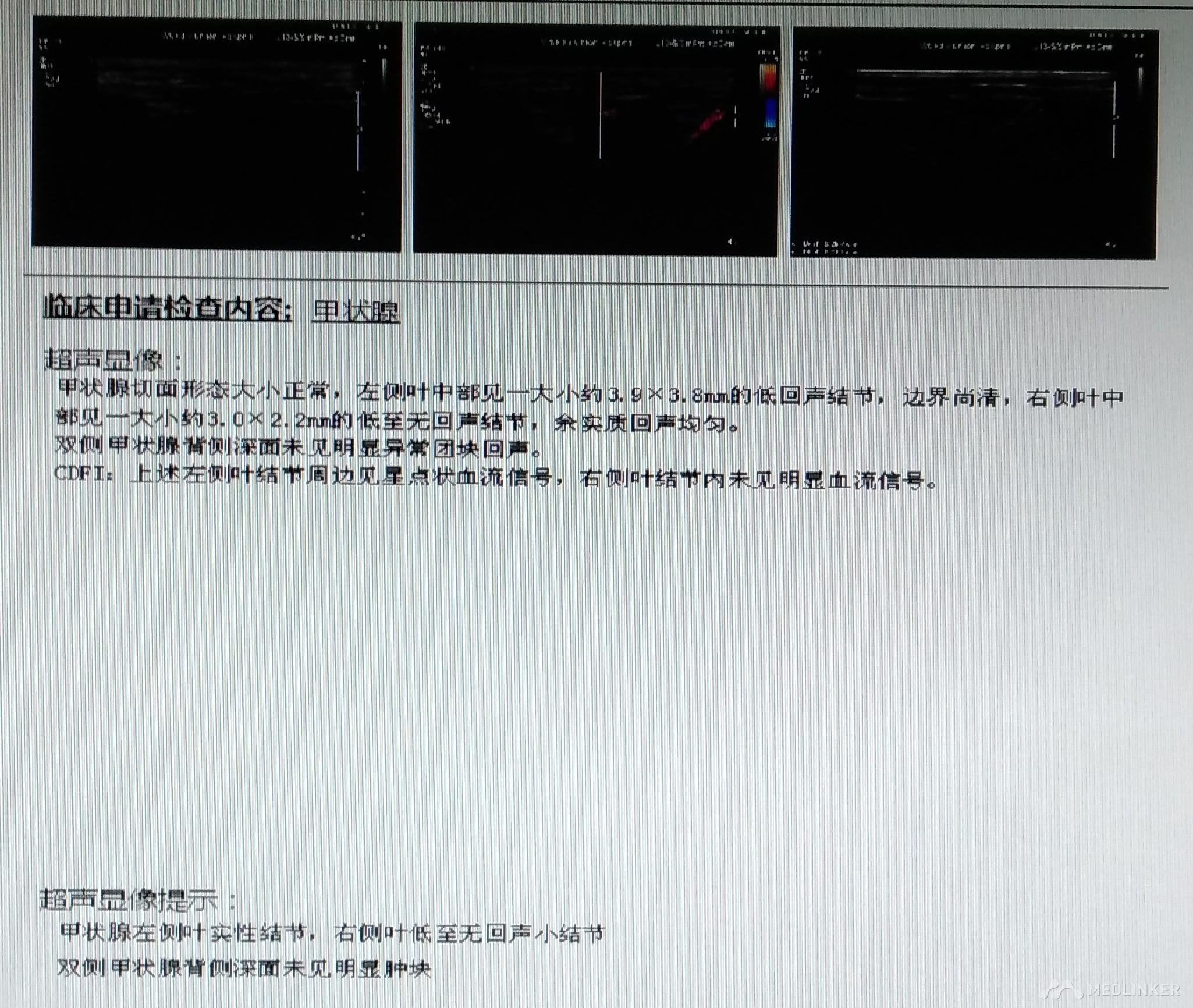 乏力